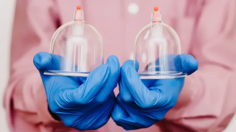 Best Days for Cupping Therapy and When to Do It