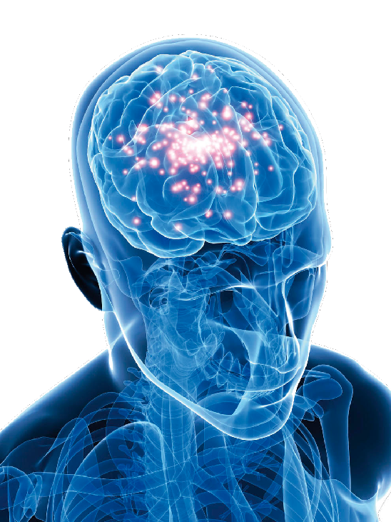 Epilepsy