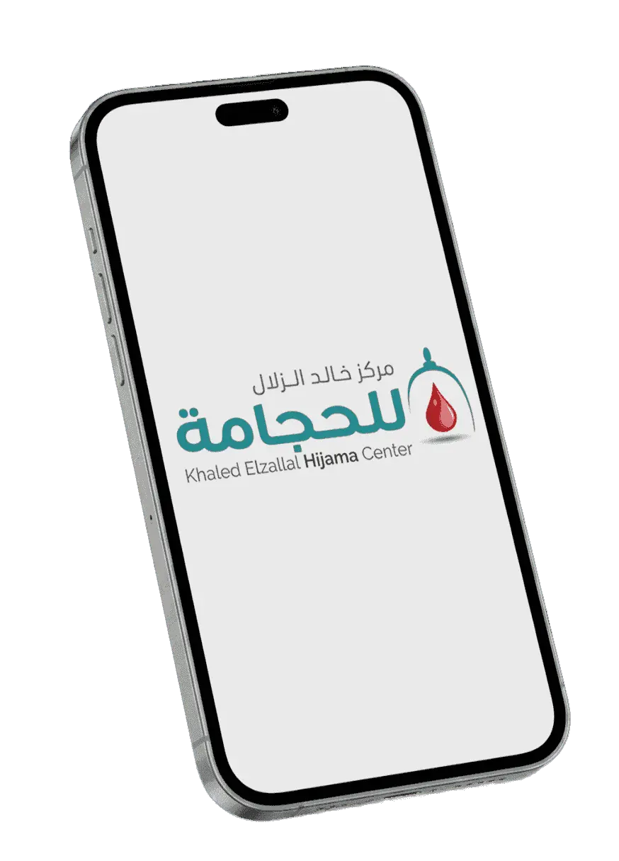 تطبيق الحجامة